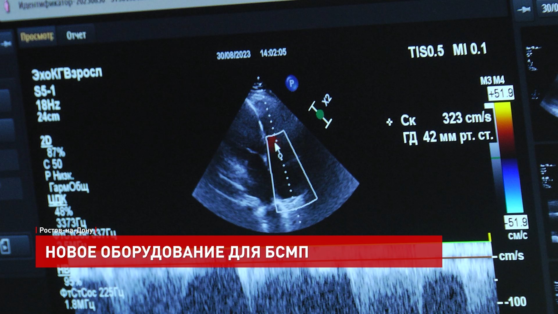 ДОН24 - Новое оборудование для БСМП южной столицы